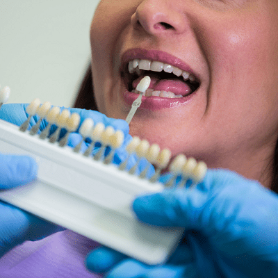 Dental Implants in Islamabad Pakistan