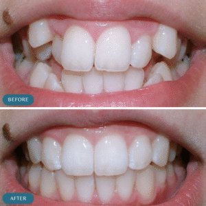 Orthodontics Treatment in Islamabad