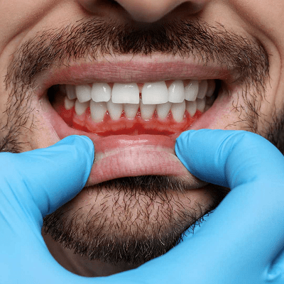 Periodontics in Islamabad
