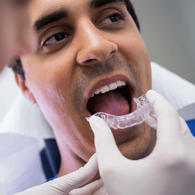 Teeth Aligners Price in Pakistan