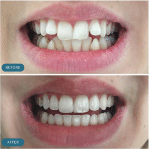 best orthodontist in islamabad pakistan