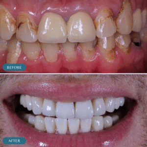 best periodontist for gum grafting in islamabad