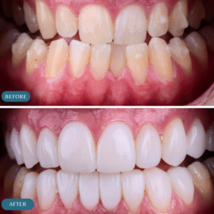 best teeth aligners in islamabad (3)