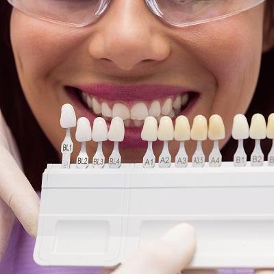 Dental Crown in Islamabad