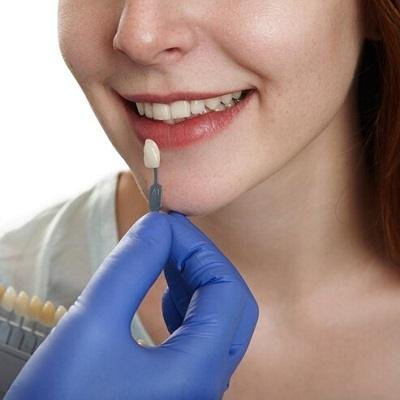 Dental Implant Cost in Pakistan