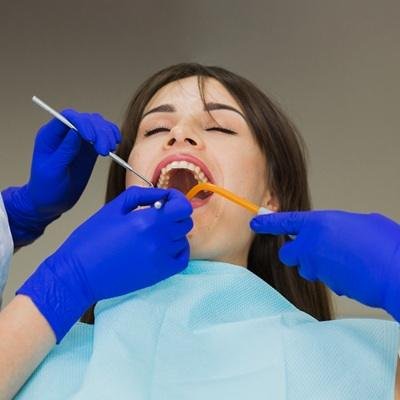 Root canal treatment price in Pakistan