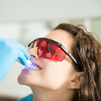 Teeth Whitening Price in Pakistan