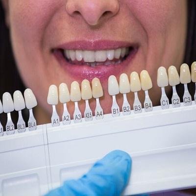 zirconia crown