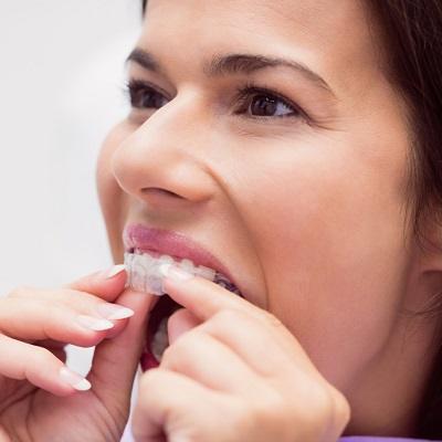 Mouth Guard Price in Islamabad