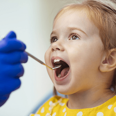 Dental Fillings for Children in islamabad , pakistan