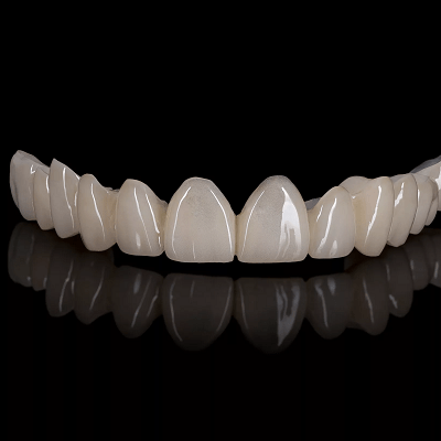 Zirconia Crown Price in Islamabad