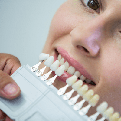 zirconia crown in islamabad, rawalpindi pakistan