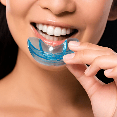 Can a mouthguard help in shaping the jawline