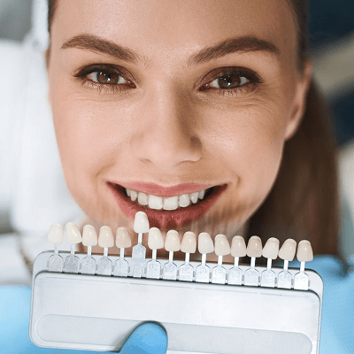 Dental Veneers Cost in Pakistan