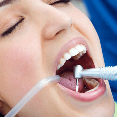 tooth filling cost in islamabad