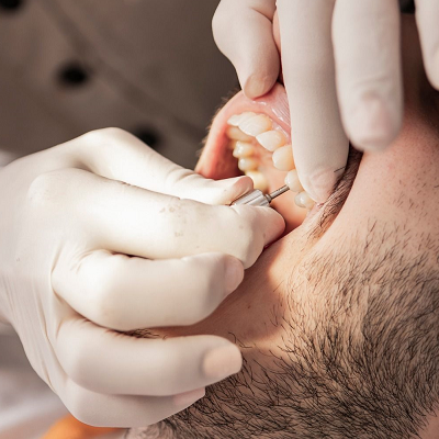 What Can You Not Do After Getting The Implant